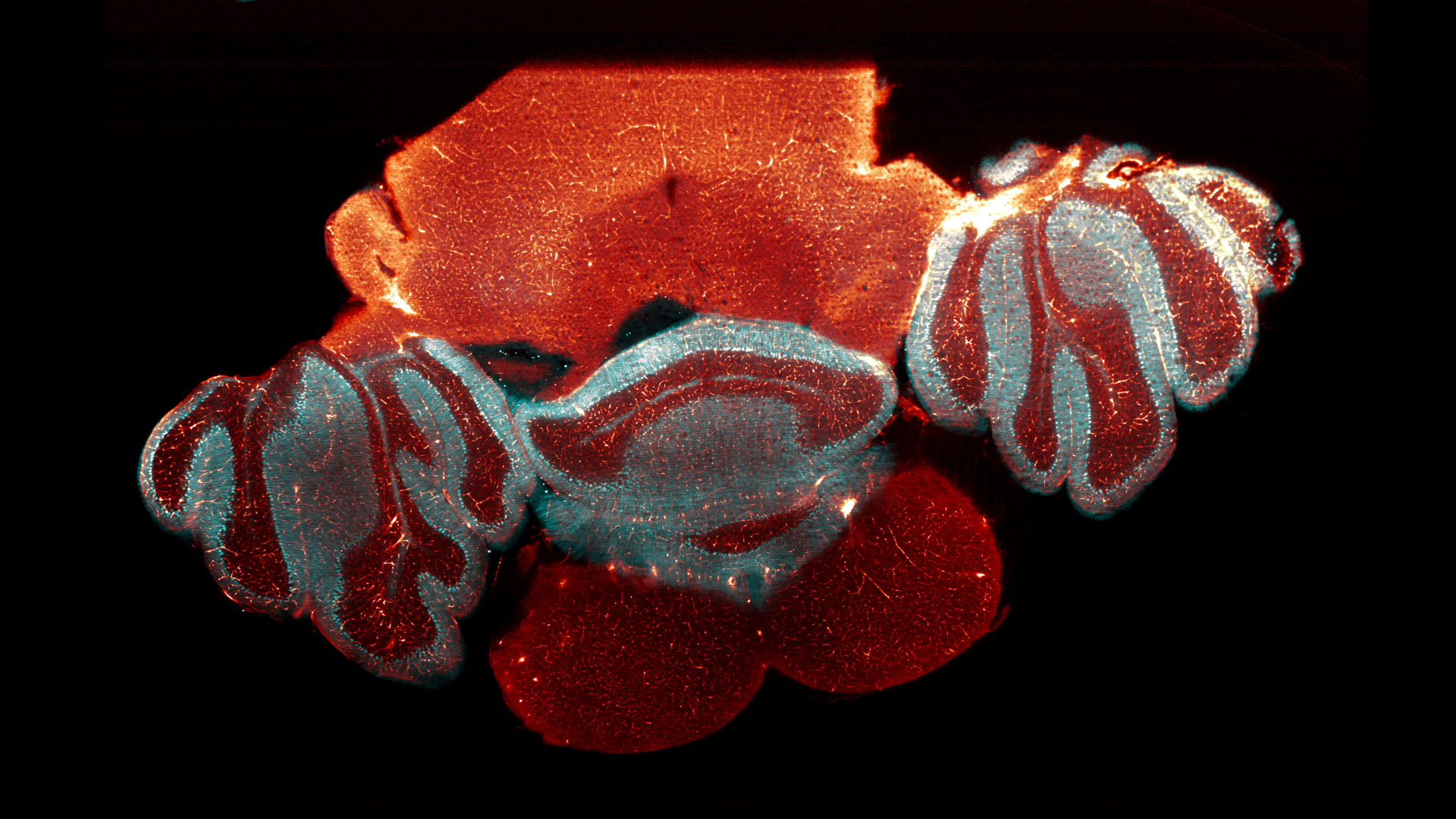Mouse cerebellum cleared using the CUBIC protocol and immunostained for beta III tubulin (orange) and calbindin (cyan).