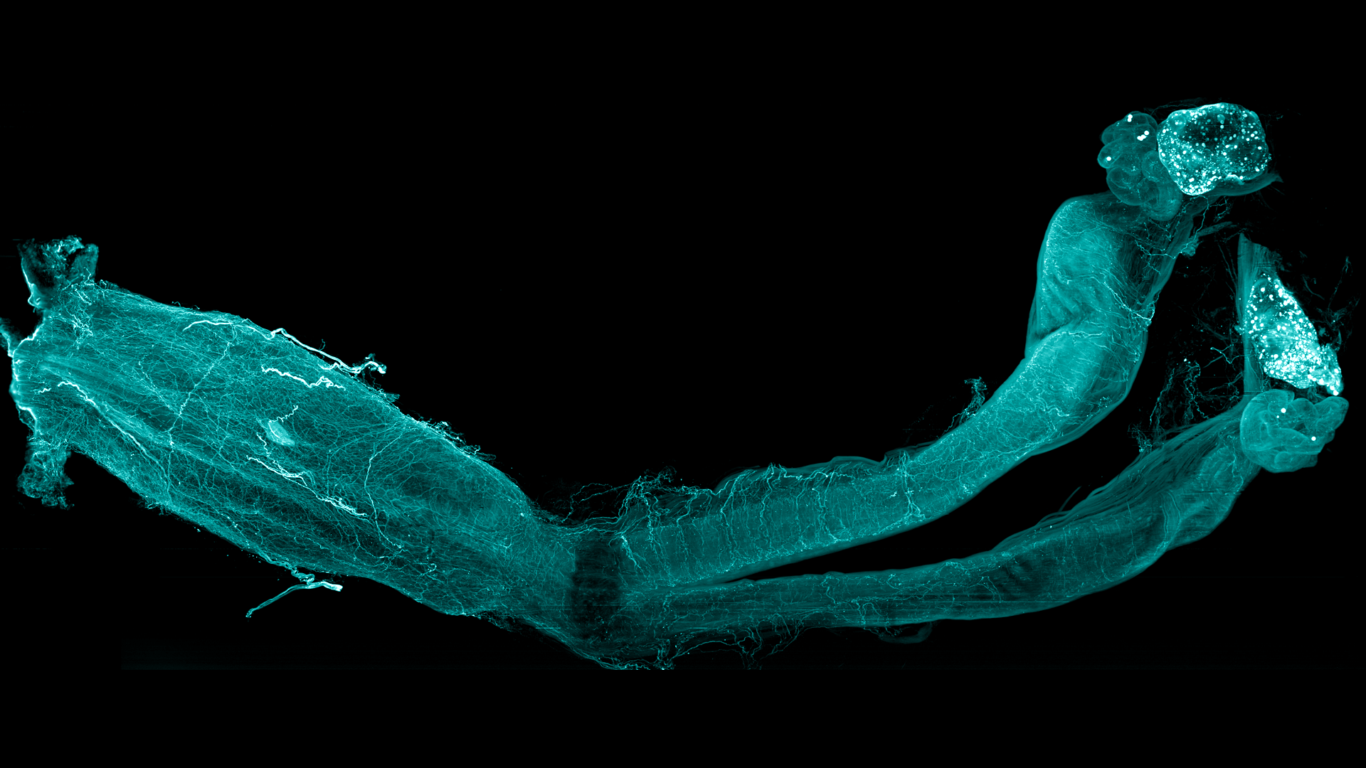 Mouse female reproductive tract cleared using the MACS protocol.