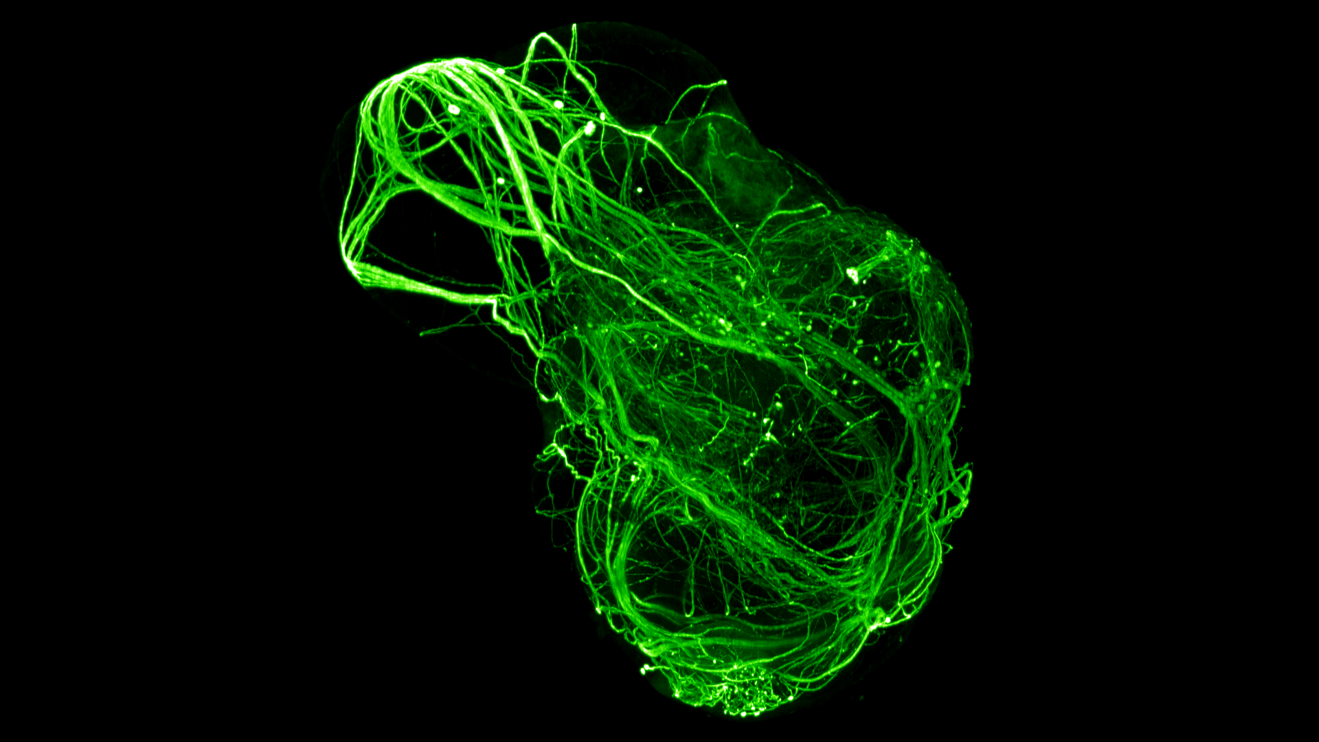 Hairy chimpanzee skin organoid cleared using the iDISCO protocol and immunostained for neurofilament H.