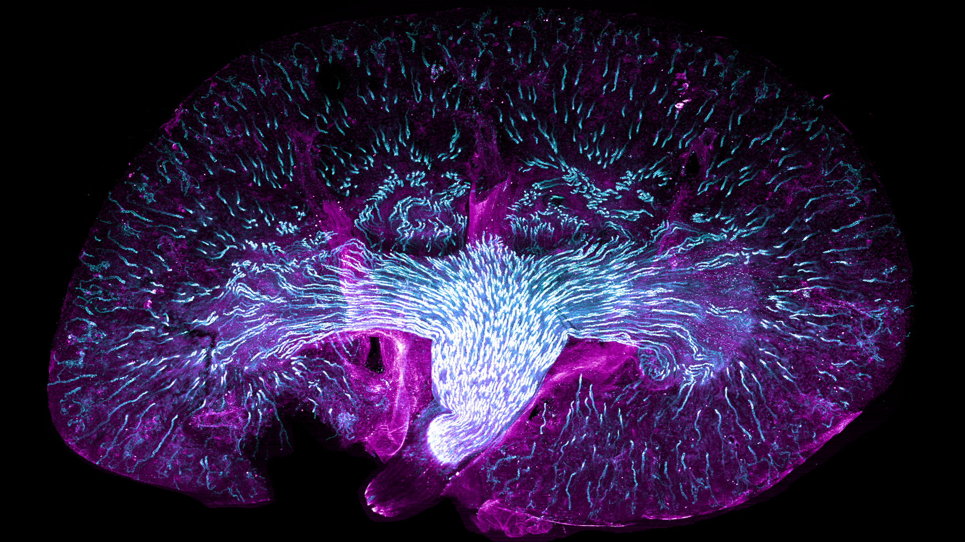 Mouse kidney cleared using the REPLICA protocol.