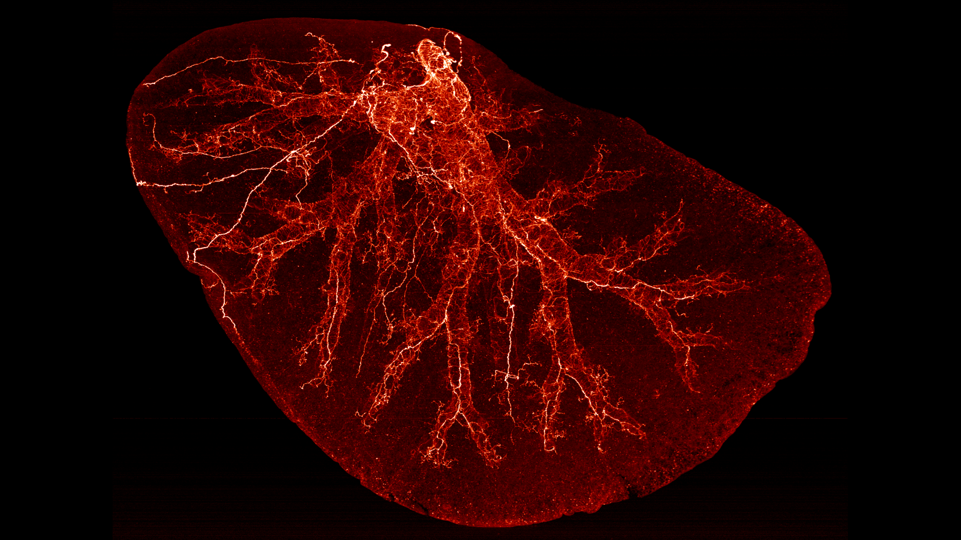 Mouse lung cleared using the MACS protocol. Displayed signal is a combination of beta III tubulin staining and autofluorescence.
